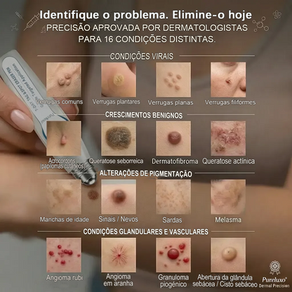 Loja Oficial 𝑷𝒖𝒓𝒆𝒍𝒖𝒙𝒐® 🌿 Tratamento de 7 Dias para Sinais e Imperfeições da Pele | Roll-on de Precisão, Sem Dor