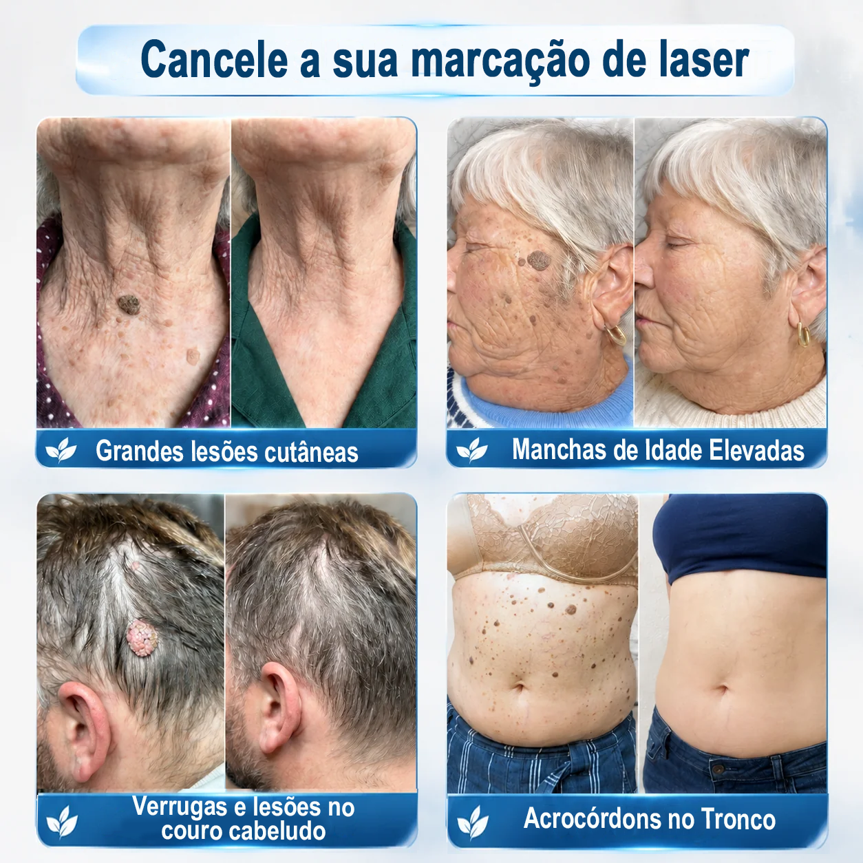 Loja Oficial 𝑷𝒖𝒓𝒆𝒍𝒖𝒙𝒐® 🌿 Tratamento de 7 Dias para Sinais e Imperfeições da Pele | Roll-on de Precisão, Sem Dor