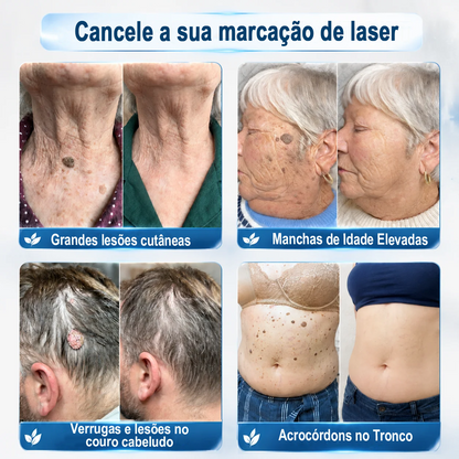 Loja Oficial 𝑷𝒖𝒓𝒆𝒍𝒖𝒙𝒐® 🌿 Tratamento de 7 Dias para Sinais e Imperfeições da Pele | Roll-on de Precisão, Sem Dor