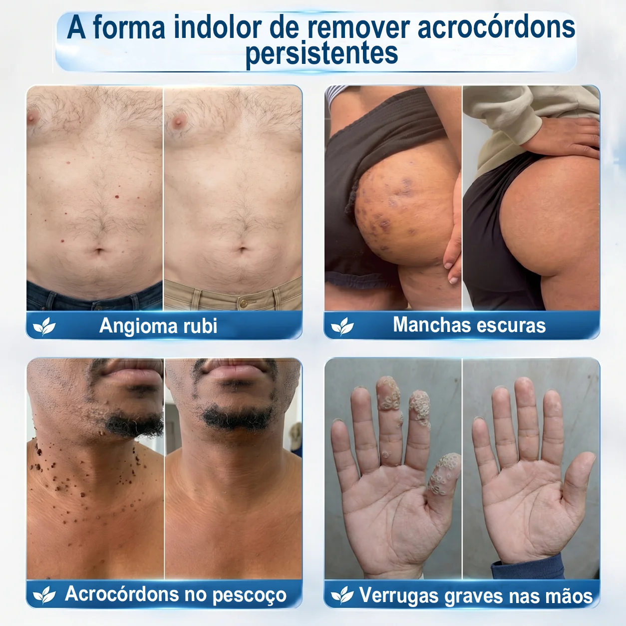Loja Oficial 𝑷𝒖𝒓𝒆𝒍𝒖𝒙𝒐® 🌿 Tratamento de 7 Dias para Sinais e Imperfeições da Pele | Roll-on de Precisão, Sem Dor